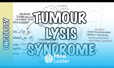 Tumour Lysis Syndrome Tumor Lysis Syndrome pathophysiology diagnosis and treatment