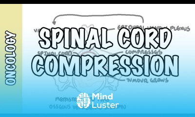 Spinal Cord Compression medical emergency causes symptoms diagnosis treatment
