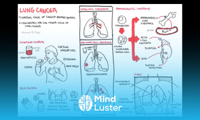 Lung Cancer Overview