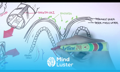 The Colon and Colon Cancer