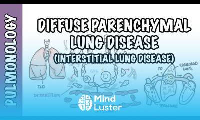 Interstitial Lung Disease ILD Classification pathophysiology signs and symptoms