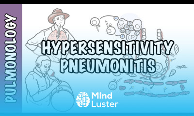 Hypersensitivity pneumonitis