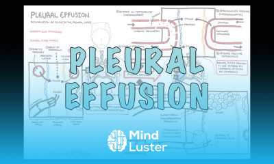 Pleural Effusion DETAILED pathophysiology signs and symptoms treatment