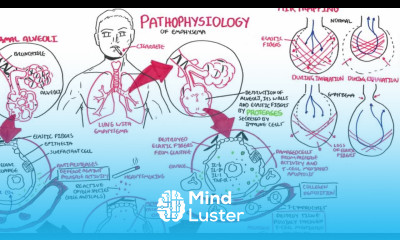 Emphysema Pathophysiology COPD