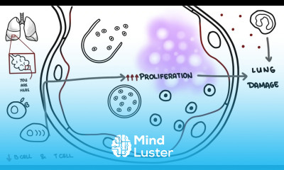 Pneumocystis jirovecii Pneumocystis pneumonia