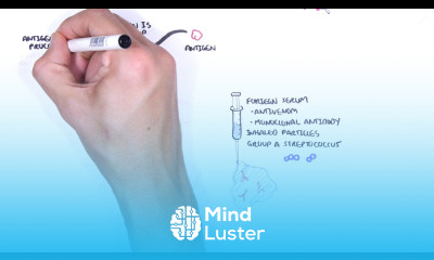 Hypersensitivity Type III Immune complex hypersensitivity causes pathophysiology