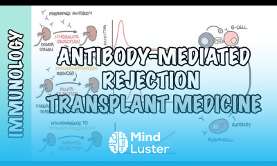 Transplant Medicine Antibody mediated rejection