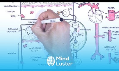 Vasculitis Pathophysiology Overview