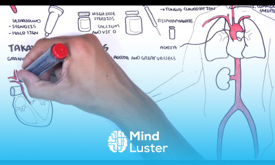 Giant cell Arteritis and Takayasu arteritis Large Vessel Vasculitis signs pathophysiology