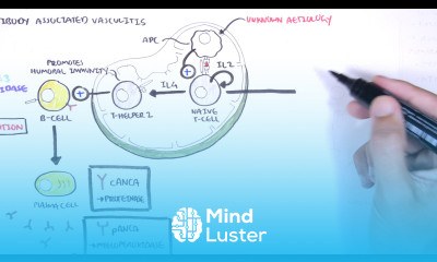 ANCA Associated Vasculitis Anti Neutrophil Cytoplasmic Antibody Causes Pathophysiology Types