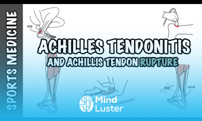 Achilles Tendonitis and Tendon Rupture Overview