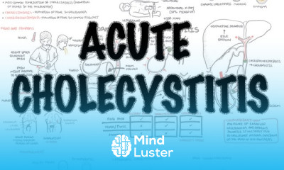 Acute Cholecystitis Overview signs and symptoms pathophysiology treatment