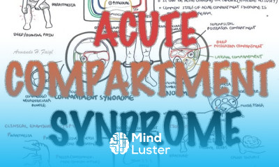 Compartment Syndrome Overview signs and symptoms pathophysiology treatment