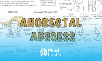 Anorectal Abscess General Surgery Overview
