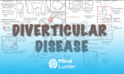 Diverticular Disease diverticulitis Overview