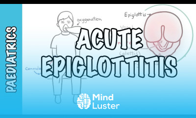 Acute Epiglottitis signs and symptoms causes pathophysiology treatment