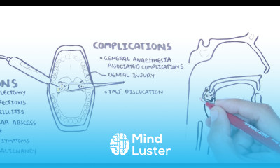 Acute Tonsillitis causes viral bacterial pathophysiology treatment tonsillectomy