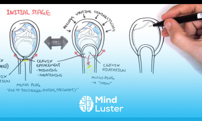 Obstetrics Stage I of Labour