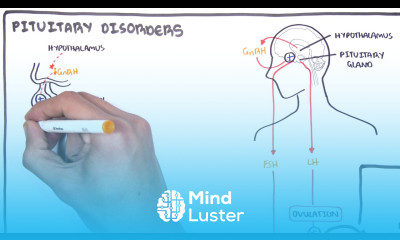 Gynaecology Infertility in Women causes and pathophysiology