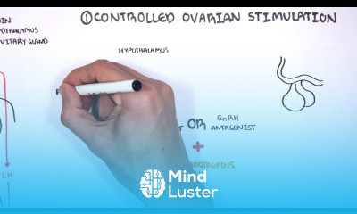 In Vitro Fertilization IVF Overview