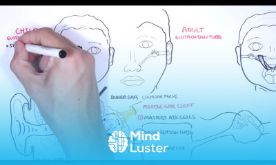 Acute Otitis Media Causes Pathophysiology signs and symptoms treatment and complications