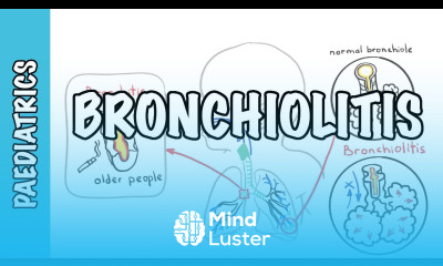 Bronchiolitis causes pathophysiology signs and symptoms treatment