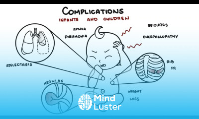 What is Pertussis and whooping cough Bordetella pertussis symptoms pathophysiology and treatment