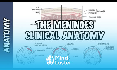 Clinical Anatomy Meninges Intracranial hematoma subdural epidural subarachnoid and meningitis