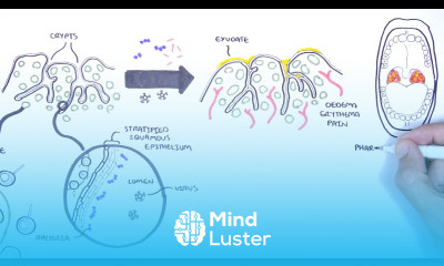 Tonsils Clinical Anatomy Palatine lingual tubal adenoids