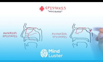 Clinical Anatomy Nasal Cavity and Nose bleeds