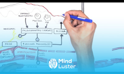 Burns Pathophysiology