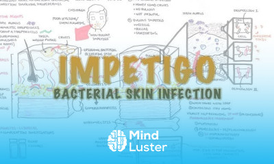 Impetigo Bacterial Skin Infection Overview Clinical Presentation Pathophysiology Treatment
