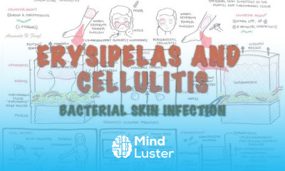 Bacterial Skin Infection Cellulitis and Erysipelas Clinical Presentation Pathology Treatment