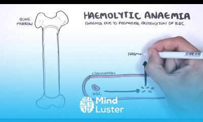 Haemolytic Anaemia classification intravascular extravascular pathophysiology investigations