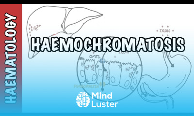 Haemochromatosis Iron Overload iron physiology causes and pathophysiology