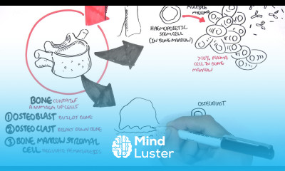 Multiple Myeloma signs and symptoms pathophysiology treatment