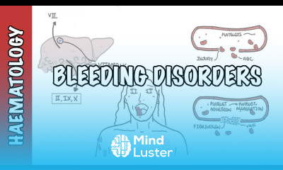 Approach to bleeding disorders causes pathophysiology and investigations