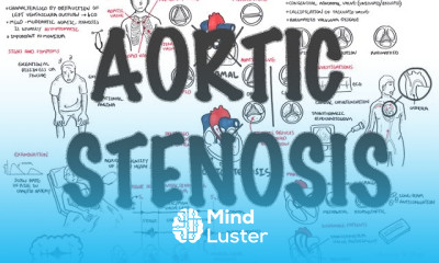 Aortic Stenosis Overview signs and symptoms pathophysiology treatment