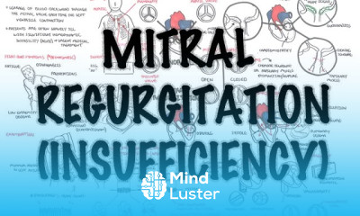 Mitral Reguritation insufficiency Overview signs and symptoms pathophysiology treatment