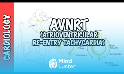 AVRNT atrioventricular re entry tachycardia causes pathophysiology treatment