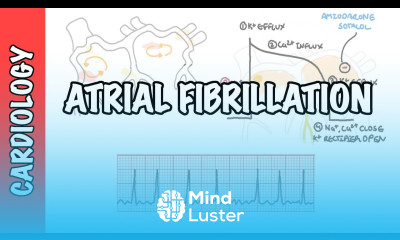 Atrial Fibrillation Overview ECG types pathophysiology treatment complications