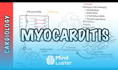 Myocarditis causes pathophysiology investigation and treatment
