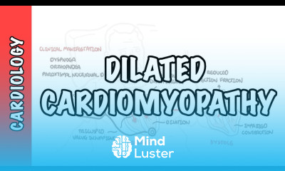 Dilated Cardiomyopathy causes symptoms pathophysiology and treatment