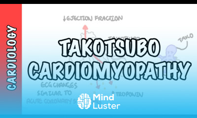 Takotsubo Cardiomyopathy Broken heart syndrome pathophysiology diagnosis and treatment