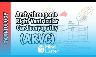 Arrhythmogenic right ventricular cardiomyopathy ARVC pathophysiology investigations treatment