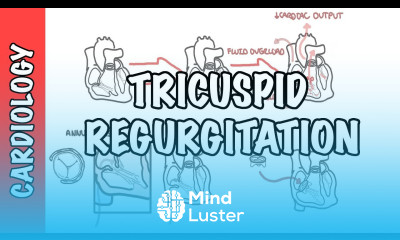 Tricuspid Regurgitation pathophysiology investigation and treatment