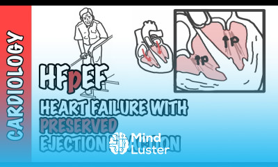 HFpEF Heart Failure with Preserved Ejection Fraction