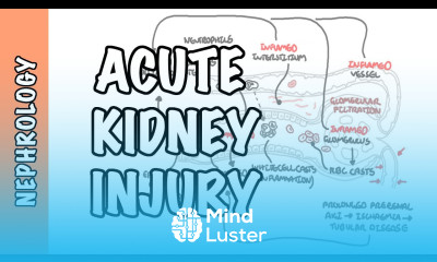 Acute Kidney Injury AKI prerenal intrarenal and postrenal causes and pathophysiology