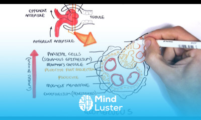 Nephrotic Syndrome Types and pathology histology