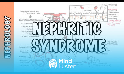 Nephritic Syndrome classification pathophysiology treatment RPGN ANCA Immune complex